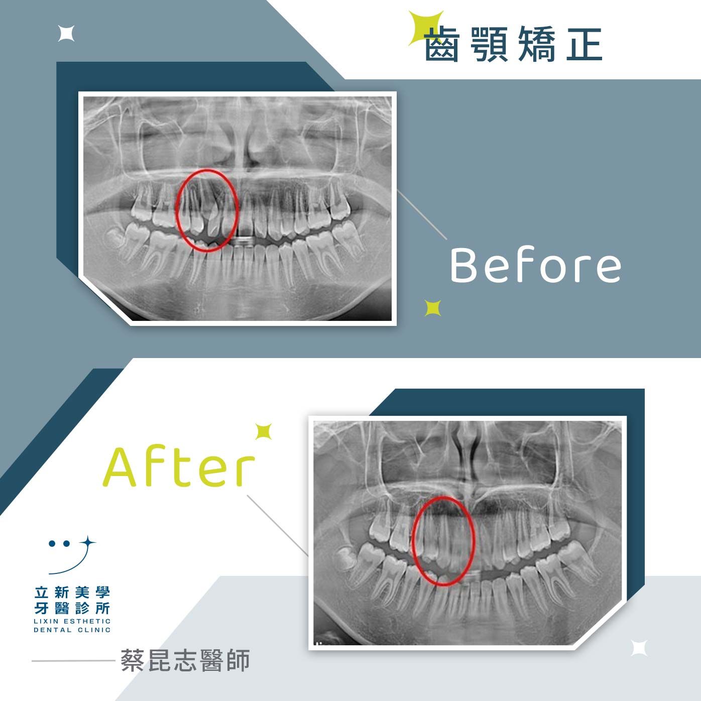 齒顎矯正 FT.蔡昆志醫師